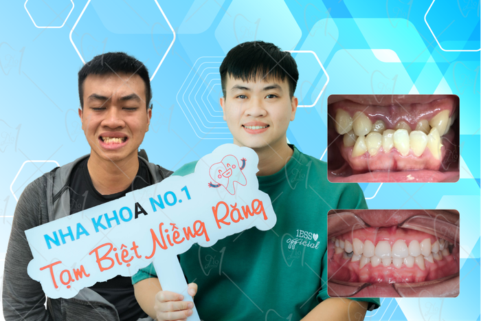 Hình ảnh phòng khám tiêu chuẩn quốc tế tại Nha Khoa No1 Đà Nẵng
