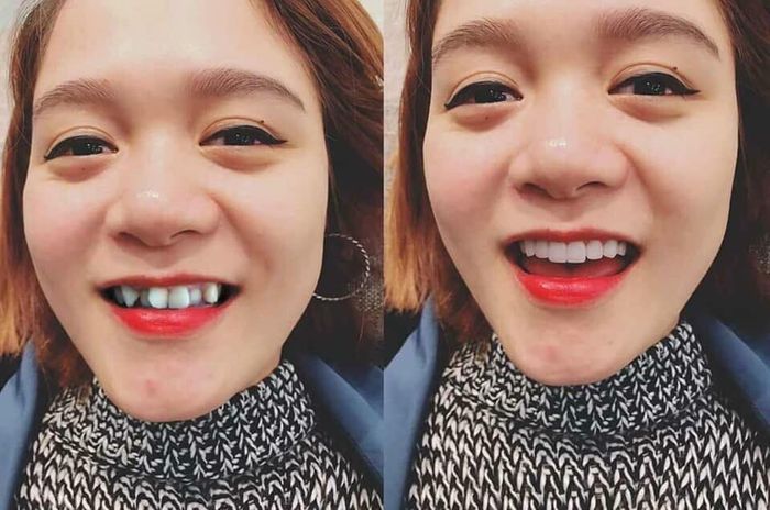 Hình ảnh hệ thống trang thiết bị tân tiến tại Nha Khoa Việt Pháp