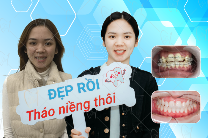 Không gian hiện đại đạt chuẩn tại Nha Khoa No1 Đà Nẵng