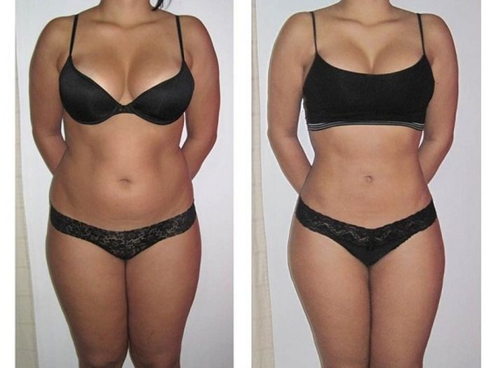 Hình ảnh minh họa hiệu quả sau khi sử dụng Mesoline Slim
