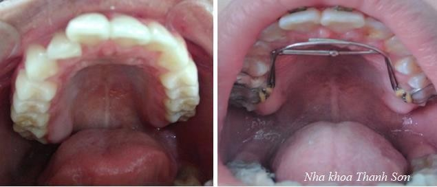 Hệ thống trang thiết bị tân tiến tại Nha Khoa Thanh Sơn