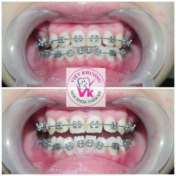 Hình ảnh đội ngũ bác sĩ chuyên nghiệp tại Nha Khoa Việt Khương