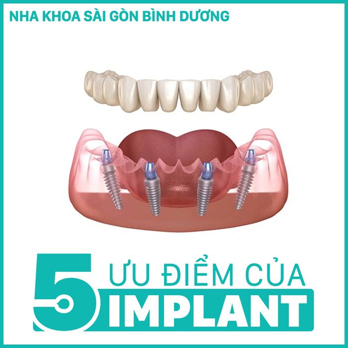 Hình ảnh hệ thống phòng khám hiện đại tại Nha khoa Sài Gòn Bình Dương