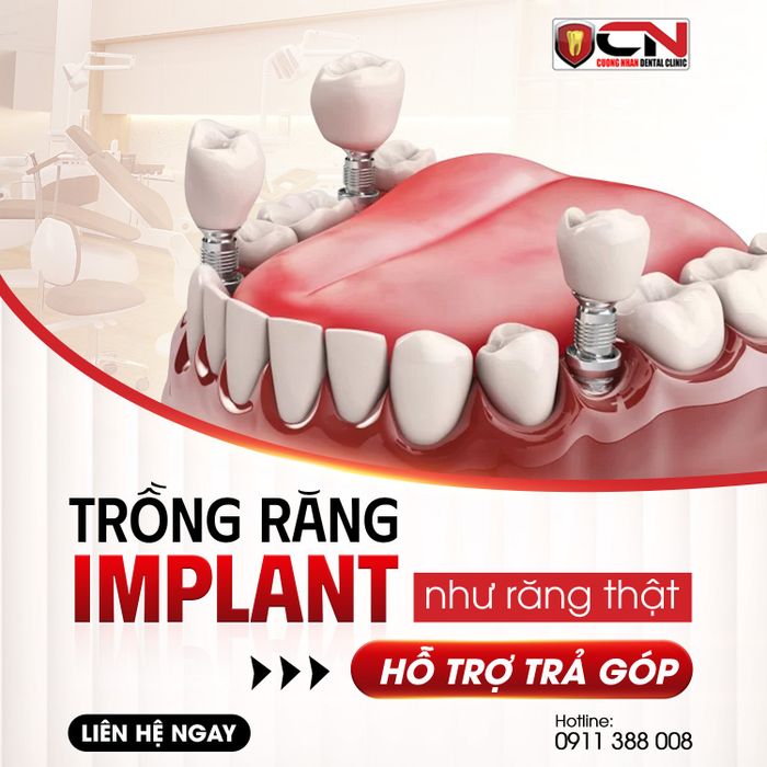 Nha Khoa Cường Nhân ảnh 2