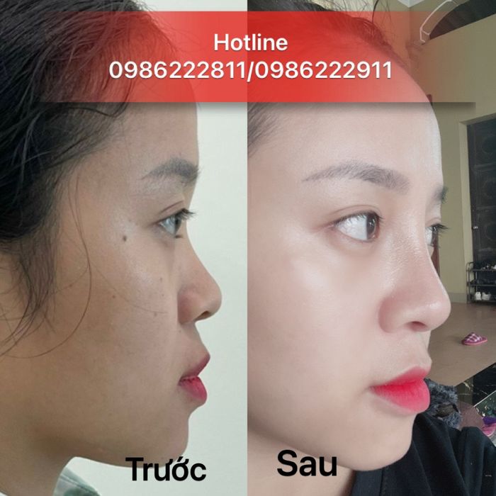 Thẩm mỹ viện Bác sĩ Hà Thanh hình ảnh 1