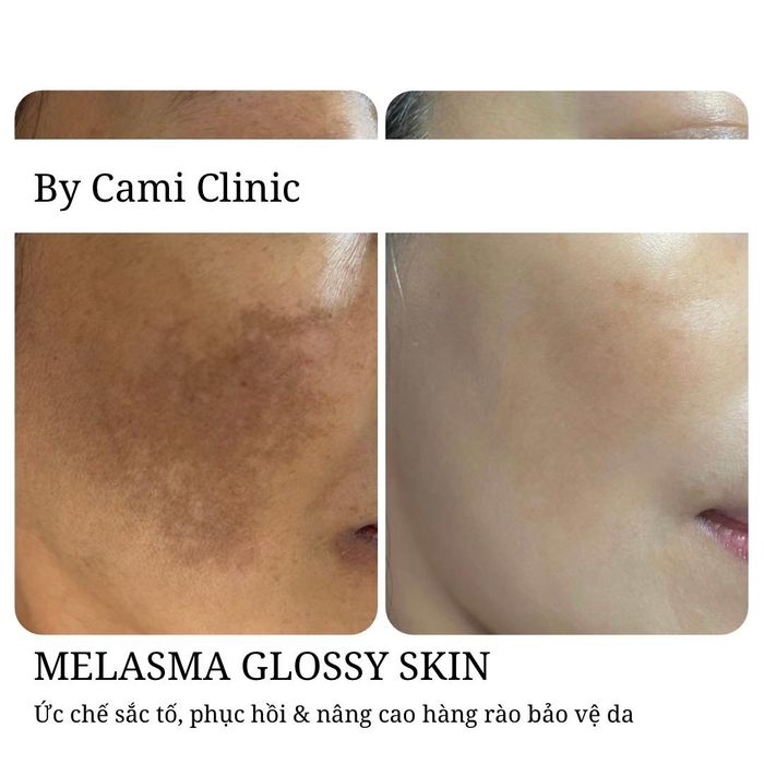 Hình ảnh nổi bật tại Cami Spa & Clinic