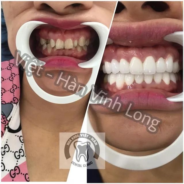 Cơ sở nha khoa tại TP. Vĩnh Long