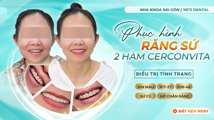 Nha khoa Sài Gòn Bình Dương ảnh 1