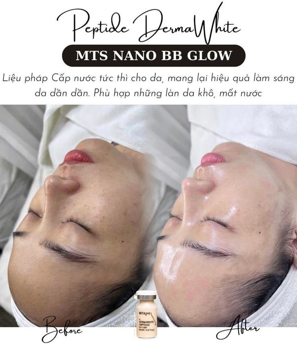 Ảnh tiêu biểu tại De PARIS Clinic Spa