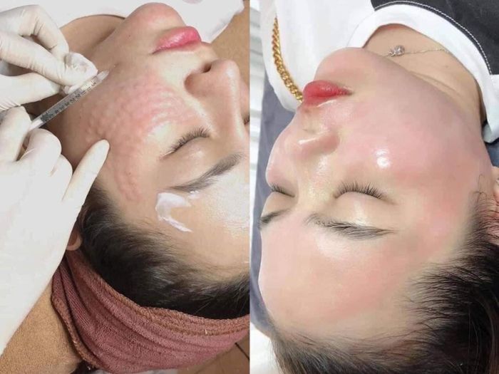 Hình ảnh sang trọng tại LOUIS SPA QUẢNG NGÃI