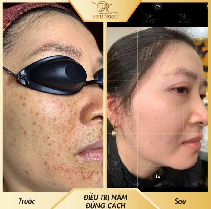 Hình ảnh tiêu biểu của Ngọc Beauty Spa & Clinic
