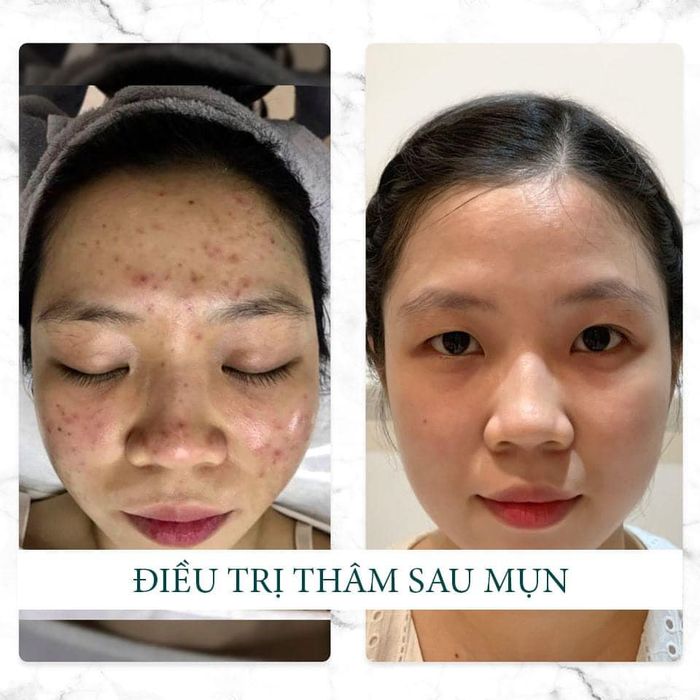 Hình ảnh nổi bật tại De PARIS Clinic Spa