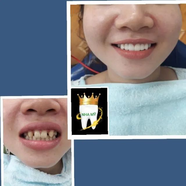 Phòng khám nha khoa tại TP. Vĩnh Long