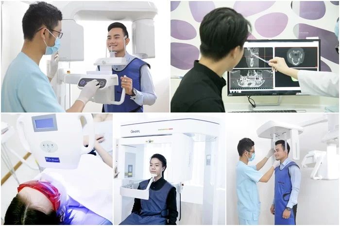Hình ảnh quy trình trồng răng công nghệ cao tại Nha Khoa Kim
