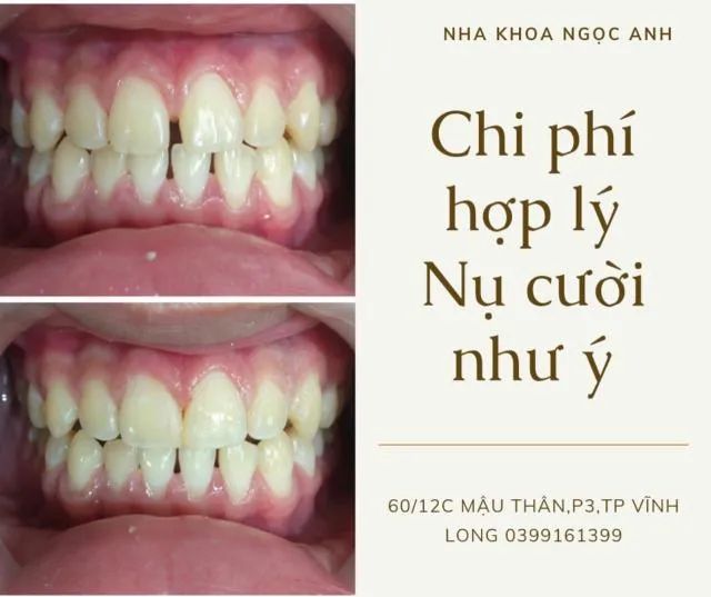 Phòng khám nha khoa Vĩnh Long