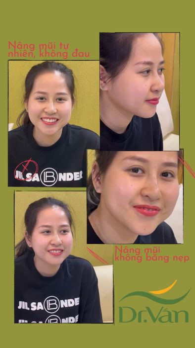 Viện Thẩm Mỹ Bác Sỹ Văn hình ảnh 1