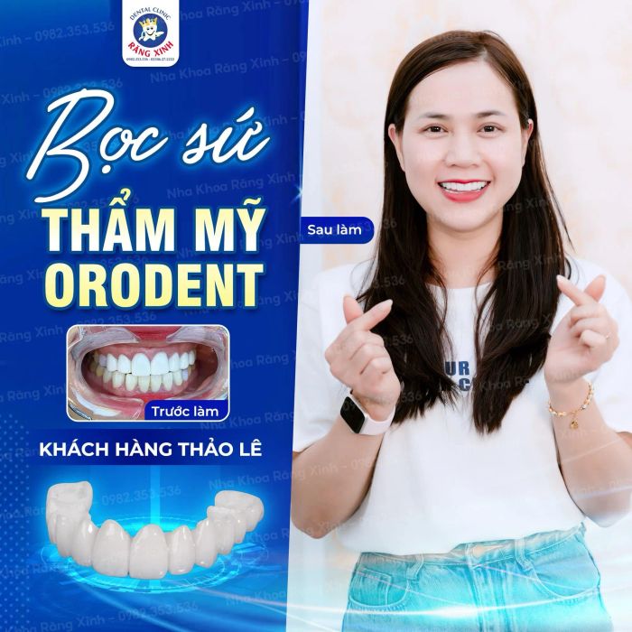 Hình ảnh quy trình bọc răng sứ chuyên nghiệp tại Nha Khoa Răng Xinh