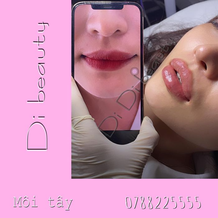 Hình ảnh Di Lê Beauty & Clinic - ảnh 2