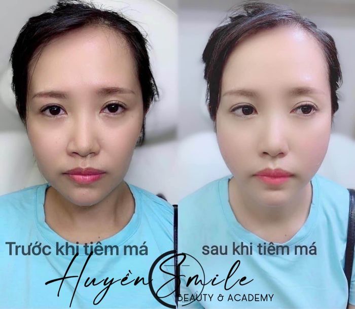 Hình ảnh Huyền Smile Beauty - ảnh 2