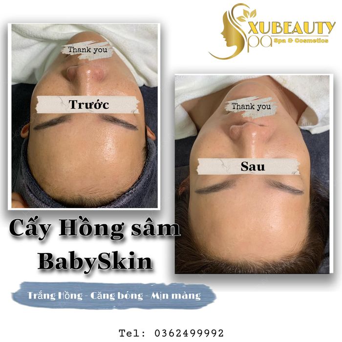 Hình ảnh HomeSpa XuBeauty lần 2