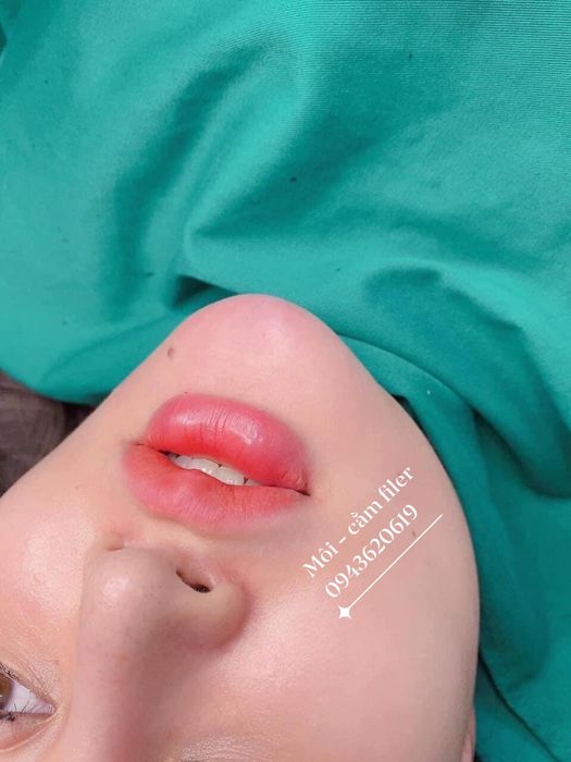 Vẻ đẹp rạng rỡ tại Cà Rốt Beauty - ảnh 2