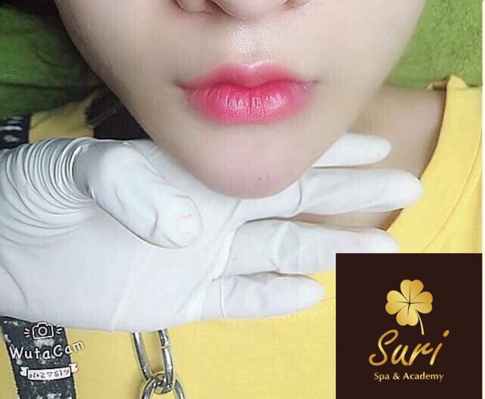 Hình ảnh Viện Thẩm Mỹ Suri - ảnh 1