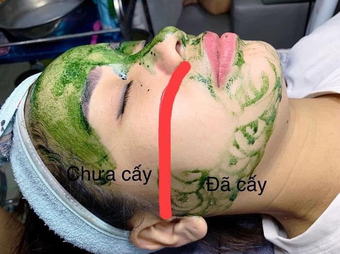 Hình ảnh Spa Mỹ Linh lần 2
