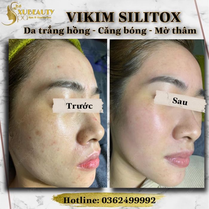 Hình ảnh HomeSpa XuBeauty lần 1