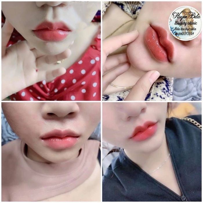 Hình ảnh tại Huyền Bela Beauty & Clinic - ảnh 1