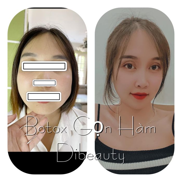 Hình ảnh Di Lê Beauty & Clinic - ảnh 1