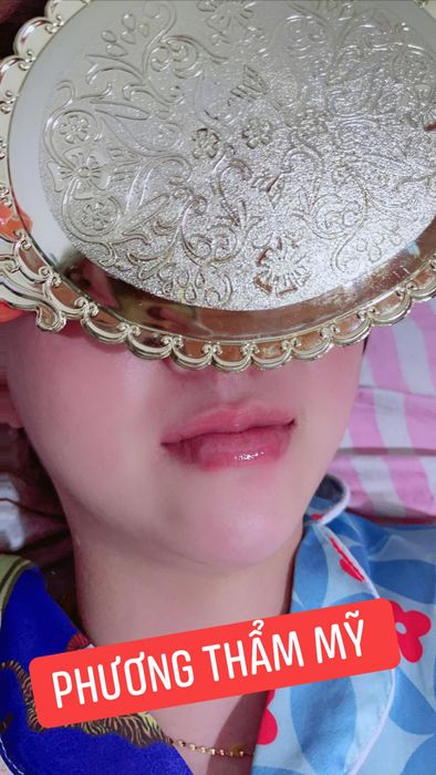 Hình ảnh Mỹ Viện Venux Beauty & Clinic - ảnh 2