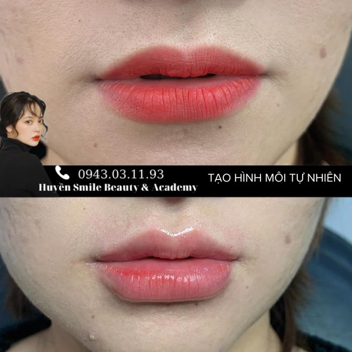 Hình ảnh tại Huyền Smile Beauty - ảnh 1