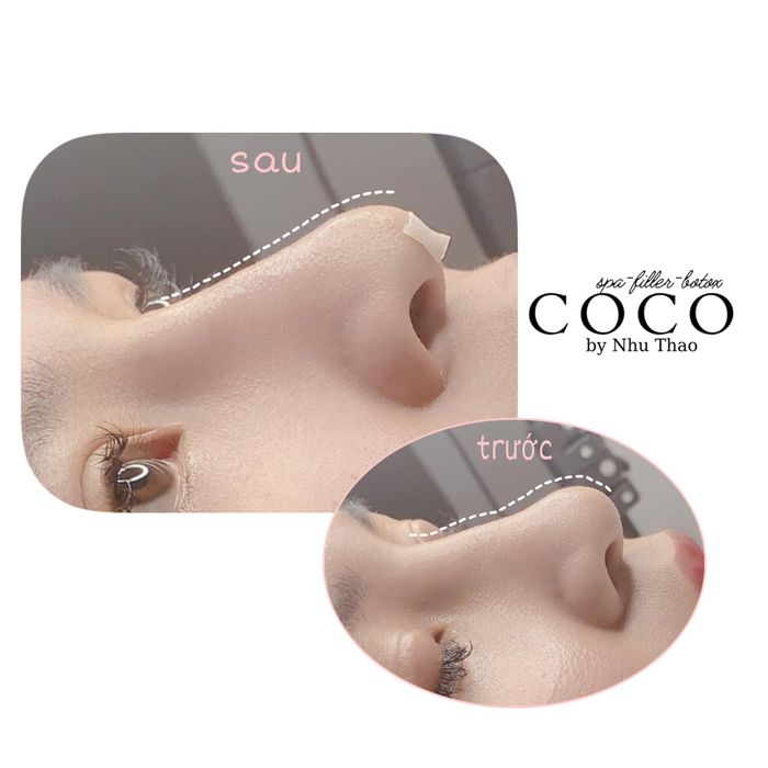 Hình ảnh thư viện đẹp mắt từ COCO Beauty Spa & Clinic