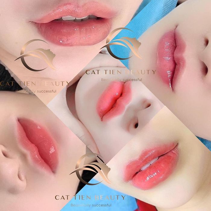 Bộ sưu tập hình ảnh khách hàng trước và sau khi trải nghiệm dịch vụ tại Viện Thẩm Mỹ Cát Tiên