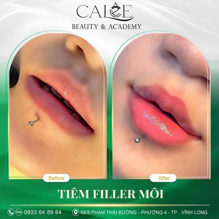 Trải nghiệm dịch vụ cao cấp tại CaLee Beauty Vĩnh Long