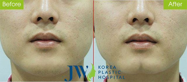Bệnh viện Thẩm mỹ JW Hàn Quốc - Tinh hoa thẩm mỹ Á Đông