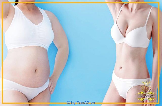 Thẩm mỹ Rio Beauty Spa – Địa chỉ giảm béo sau sinh uy tín tại Hà Nội