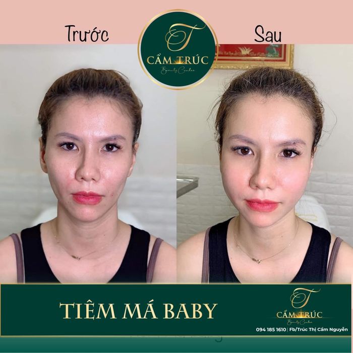 Không gian sang trọng và hiện đại tại Cẩm Trúc Beauty Center