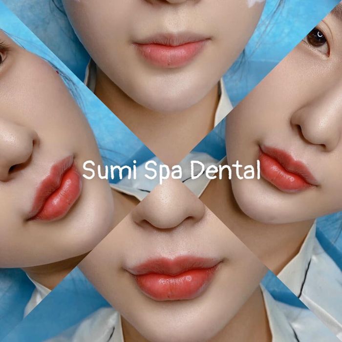 Bộ sưu tập hình ảnh khách hàng trước và sau khi trải nghiệm dịch vụ tại Spa Sumi