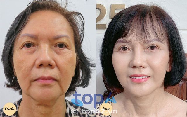 Viện thẩm mỹ Hà Nội - Địa chỉ vàng cho dịch vụ trẻ hóa da mặt