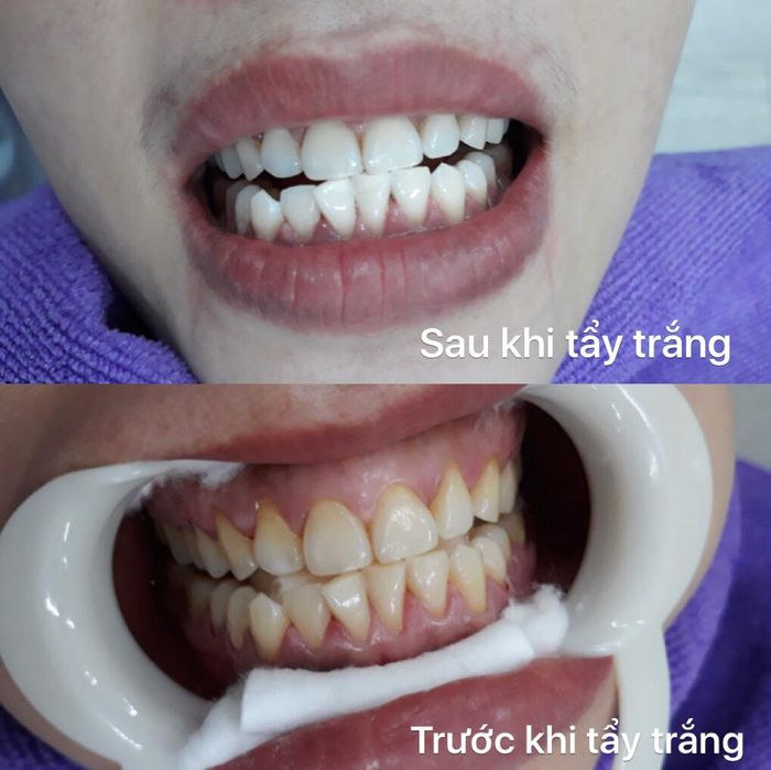 Hình ảnh Nha Khoa Thẩm Mỹ Việt Hà