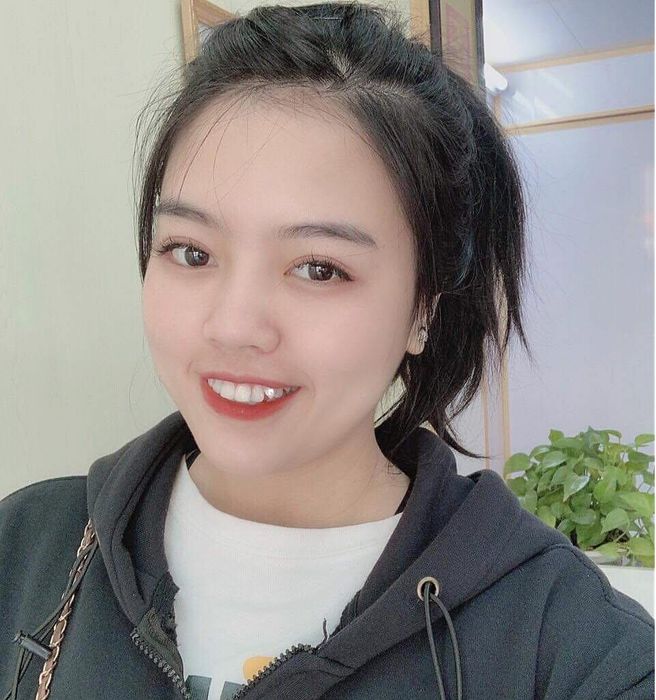 Hình ảnh thực tế tại Nha Khoa Thẩm Mỹ Việt Hà