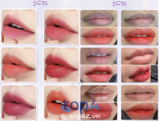 Phòng Khám Thẩm Mỹ Thảo Xinh - Địa chỉ phun môi chuẩn y khoa tại Gò Vấp