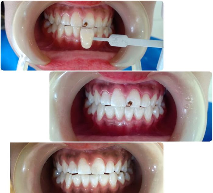 Không gian hiện đại tại Nha Khoa Thẩm Mỹ MAX Nam Định