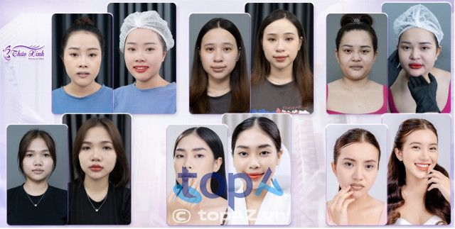 Phòng Khám Thẩm Mỹ Thảo Xinh - Địa chỉ phun xăm môi chuẩn y khoa tại Gò Vấp, TP.HCM