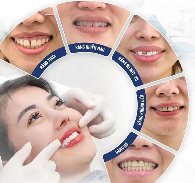 Những phòng khám nha khoa tại TP. Pleiku, Gia Lai có mức giá hợp lý và chất lượng đảm bảo.