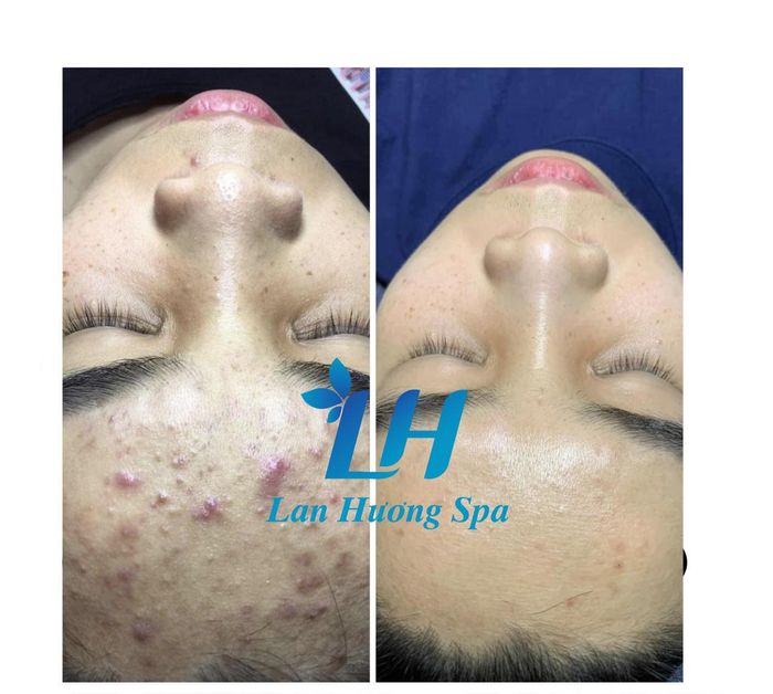 Không gian sang trọng tại Lan Hương Home Spa Đồng Xoài