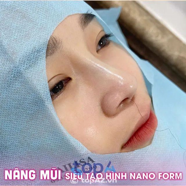 Gợi ý địa chỉ nâng mũi uy tín, chất lượng tại Bình Dương