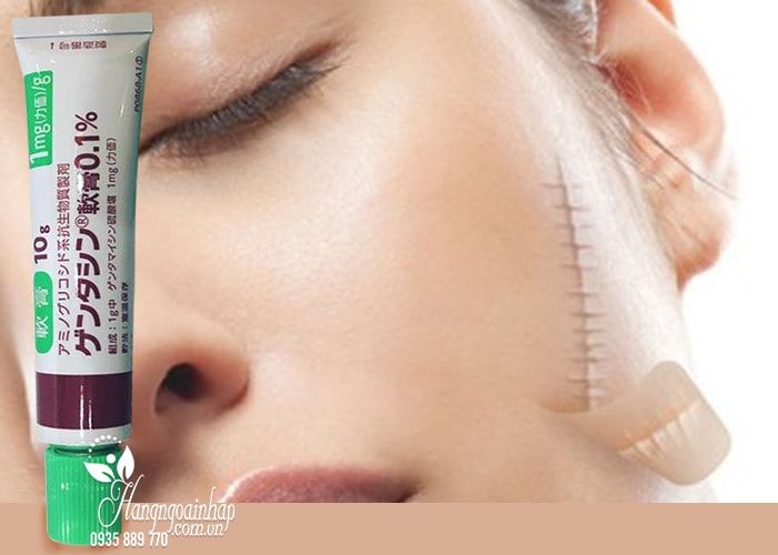 Kem Trị Sẹo Gentacin Nhật Bản - minh chứng cho công nghệ làm đẹp đỉnh cao (Ảnh minh họa 2)