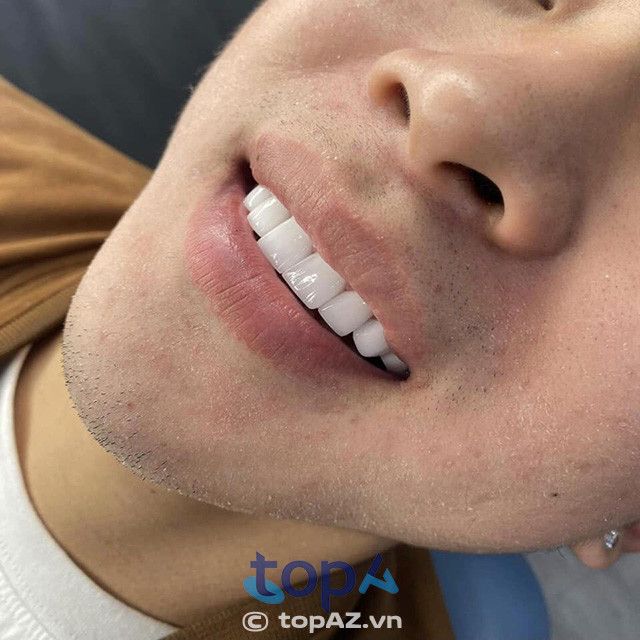 Nha khoa Việt Mỹ - Địa chỉ vàng cho nha khoa thẩm mỹ tại Đà Lạt